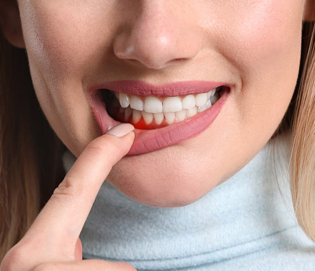 warwick_smiles_gum-health